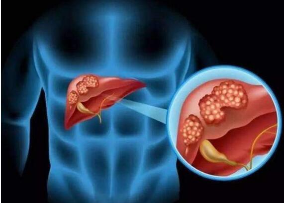 熬夜喝什么茶养肝护肾